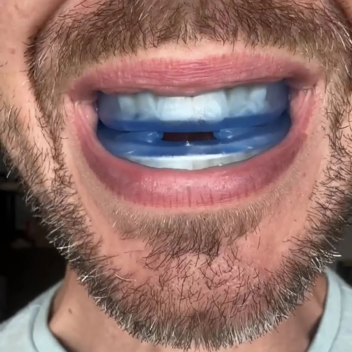Silent Night Mouthpiece 2 in 1